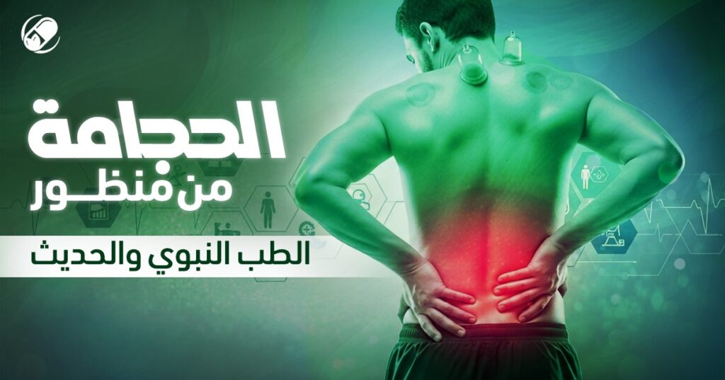 فوائد الحجامة